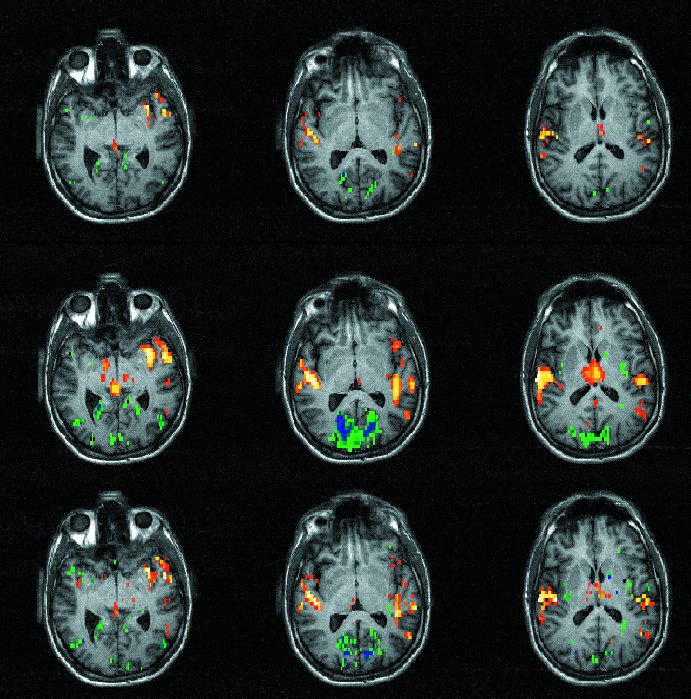 FMRI Preprocessing