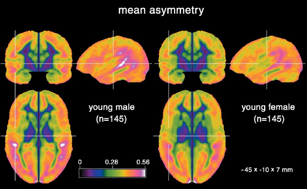 Brain Asymmetry